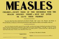 measles